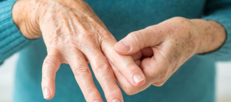 Artrit Nedir? Belirtileri Nelerdir?